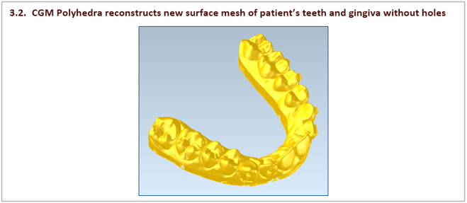 CGM Polyhedra reconstructs new surface mesh of patient’s teeth and gingiva without holes